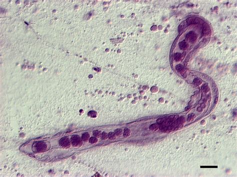 Zygomyces! En mikroskopisk parasit med ett komplex liv och en smak för celler.