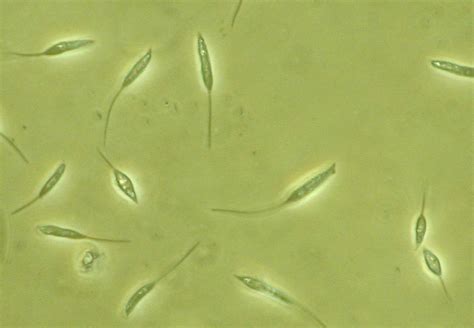   Leptomonas! En mikroskopisk varelse med en komplex livsstil och oväntade superkrafter