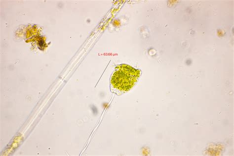  Vorticella!  En fascinerande vortex av mikroskopiska liv i sötvattensmiljöer